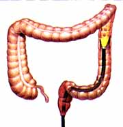 colon